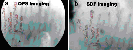 Renal microcirculation,kidney microcirculation,sublingual microcirculation,Tongue microcirculation,lingua microcirculation