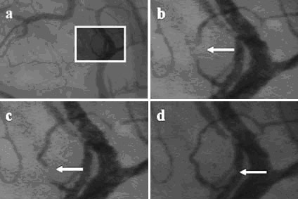 Renal microcirculation,kidney microcirculation,sublingual microcirculation,Tongue microcirculation,lingua microcirculation