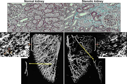 Renal microcirculation,kidney microcirculation