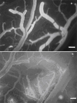 Cerebral microcirculation, brain microcirculation