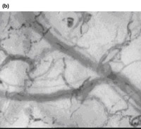 sublingual microcirculation,clinical microcirculation,Tongue microcirculation,lingua microcirculation