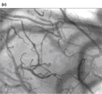 sublingual microcirculation,clinical microcirculation,Tongue microcirculation,lingua microcirculation