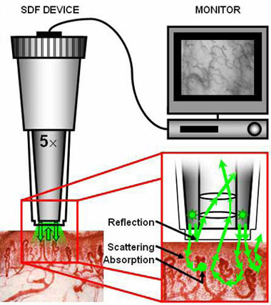 sidestream dark field (SDF) handheld imaging device,Microvascular (blood) image observation instrument