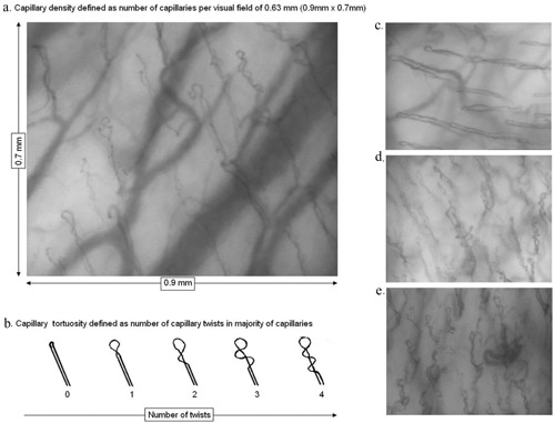 sidestream dark field (SDF) handheld imaging device,Microvascular (blood) image observation instrument,SDF imaging device