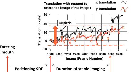 Sidestream Dark Field (SDF) imaging,Sidestream Dark Field(SDF),SDF imaging device