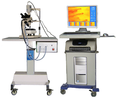 Microcirculation,high-resolution microscope,ultra microscope,high-magnification microscope